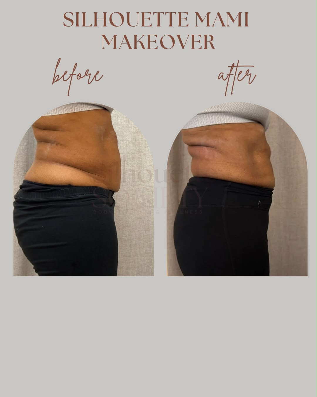 Silhouette Mami Makeover before and after, client one